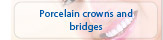 Porcelain Crowns & Bridges